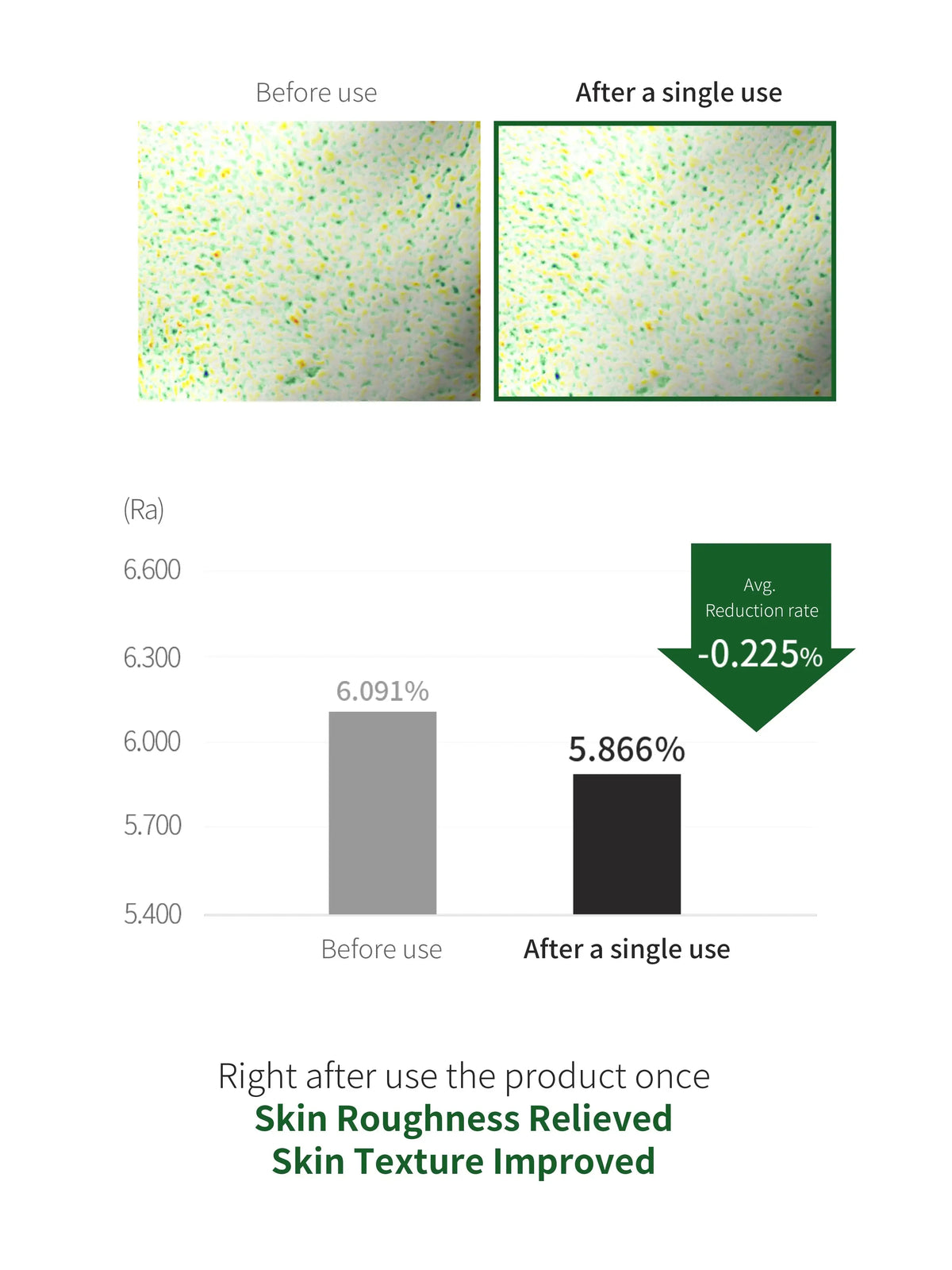 Benton Aloe BHA Skin Toner 200ml - Renewal — Exfoliating Toner — product detail 9