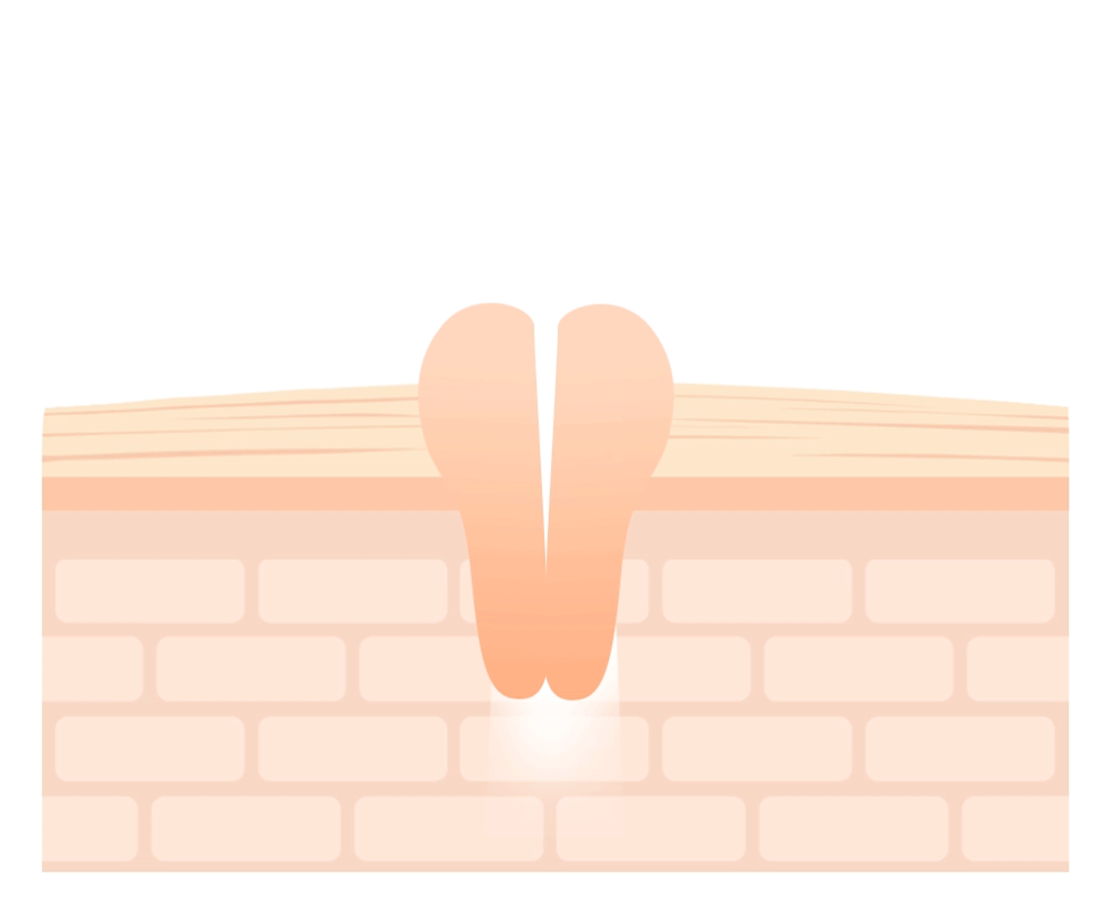 Needly Crossbarrier Mask 30 sheets Korean product view 9