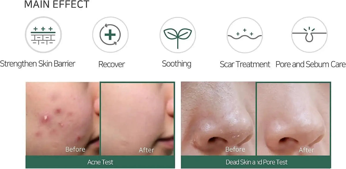 SomeByMi Korean acid cream product view 7