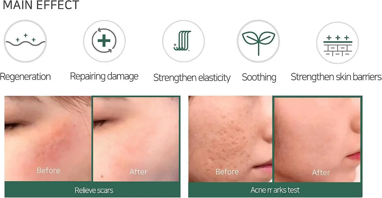 SomeByMi Korean acid cream product view 9
