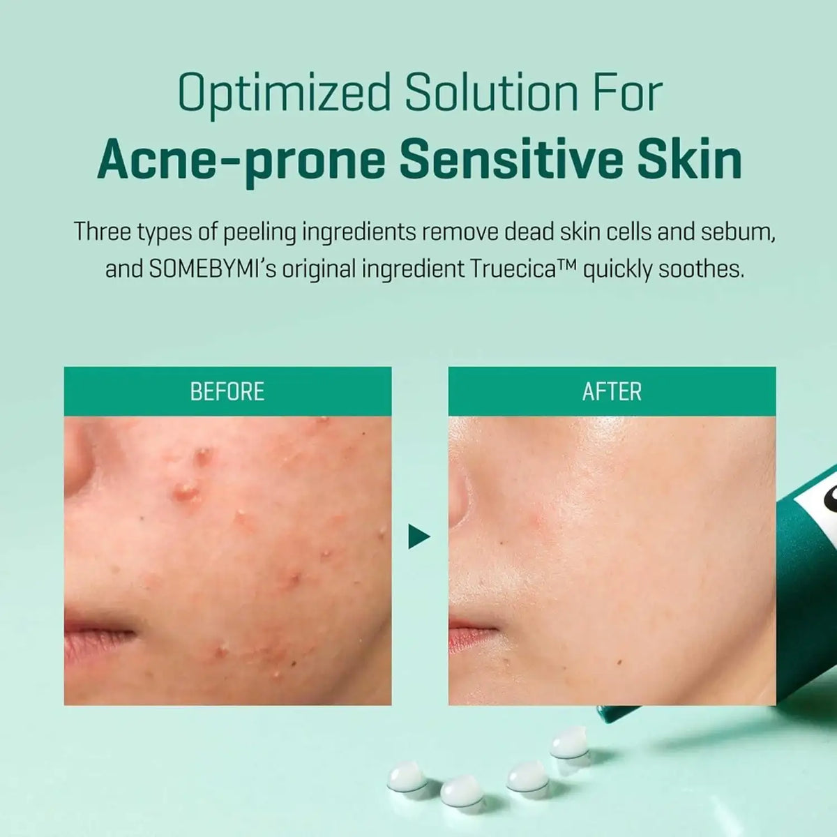 SomeByMi Korean acid cream product view 7