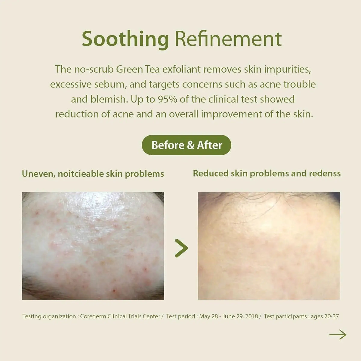 Blithe Patting Splash Mask Soothing & Healing Green Tea 150ml — Sheet Mask — product detail 6