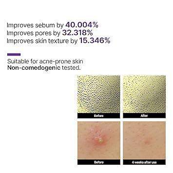 SomeByMi Korean retinol serum product view 5