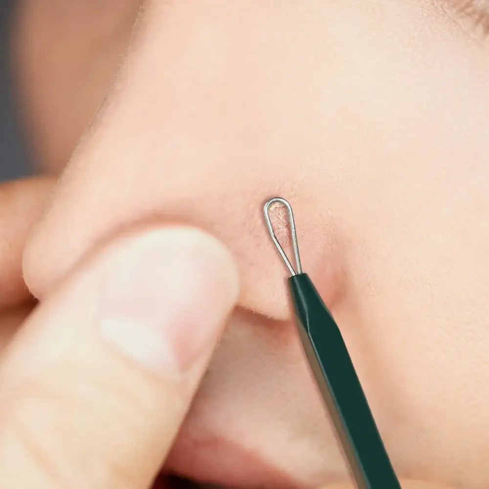 PyunkangYul Pimple Extractor Korean product view 3