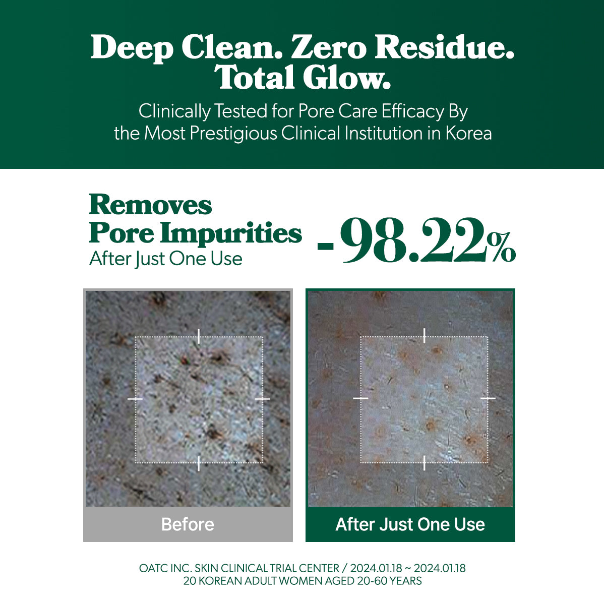 Omitted Fresh Lime Pore Clearing Deep Cleansing Oil 200ml | Gentle & Effective Makeup Remover